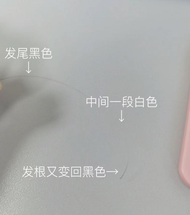 头发白了一截，还能“黑”回去吗？真相来了-3.jpg